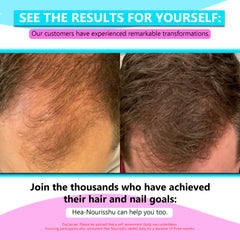 Hea-Nourisshu - Advanced Hair Growth Tablets