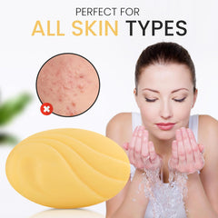 Acne Soap All skin Types